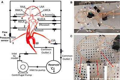 Modeling flow in an in vitro anatomical cerebrovascular model with experimental validation